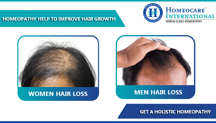 Hair Loss Solutions For Thyroid Patients | Homeocare International