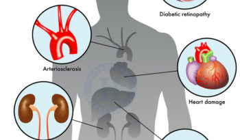 symptoms-of-diabetes