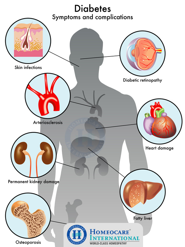 symptoms-of-diabetes