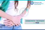 Get best PCOS Treatment in Homeopathy