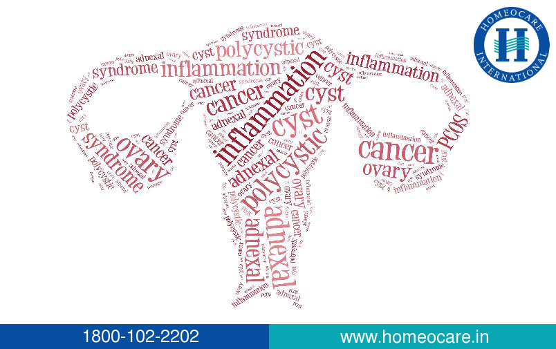 homeopathy-pcos-treatment