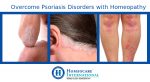 Overcome Psoriasis Disorders with Homeopathy
