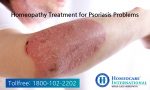Homeopathy Treatment for Psoriasis problems