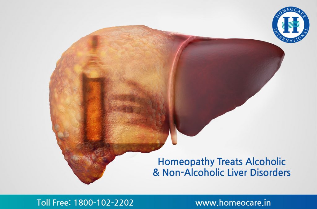 Homeopathy Treats Alcoholic Non-Alcoholic Liver Disorders