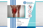 Ease Osteoarthritis Pain with Advanced Constitutional Homeopathy
