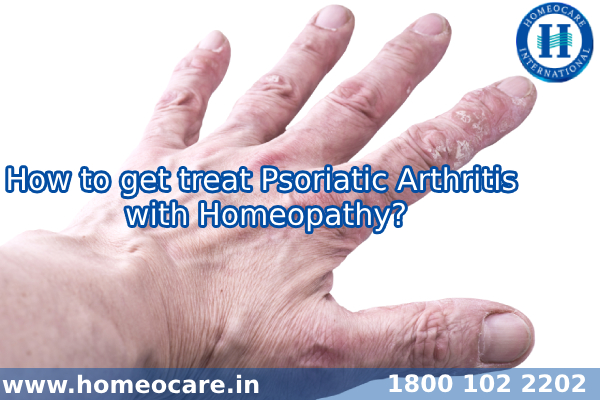 How to get treat Psoriatic Arthritis with Homeopathy?