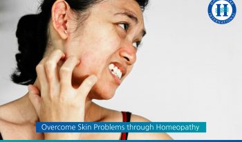 Overcome Skin Problems through Homeopathy