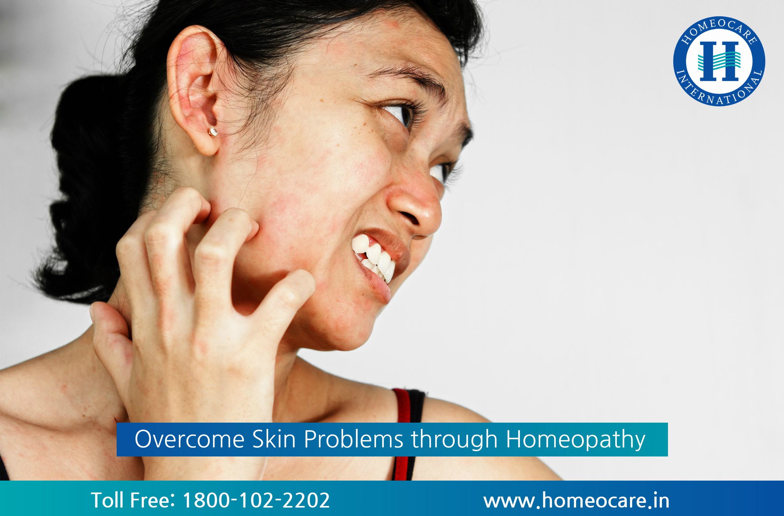 Overcome Skin Problems through Homeopathy