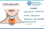 Homeopathy Treatment for Hyperthyroidism