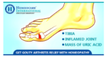 Facts Everyone Should Know About Homeopathy Treatment For Gout Arthritis