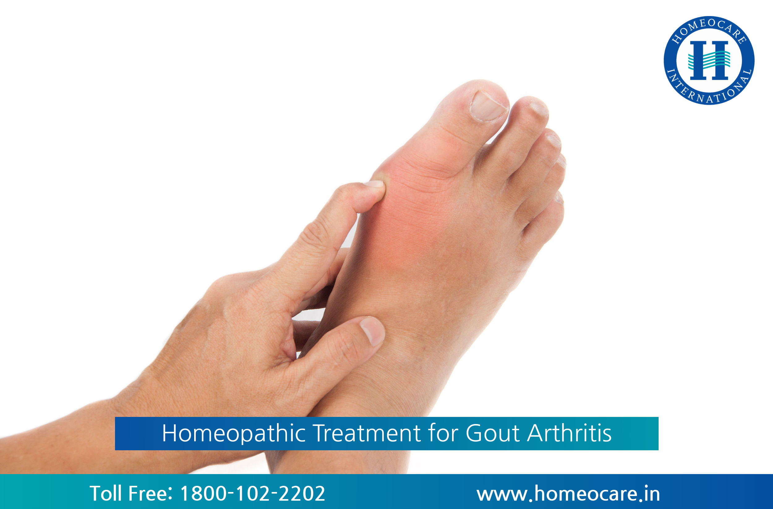 Homeopathy Treatment for Gout Arthritis