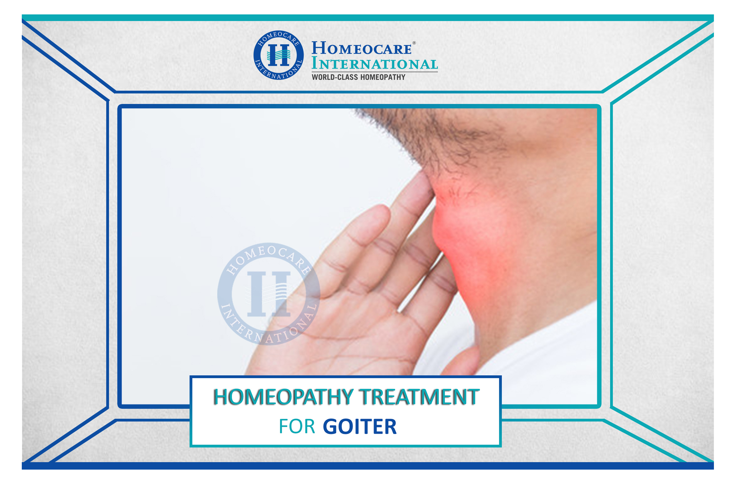 goiter1