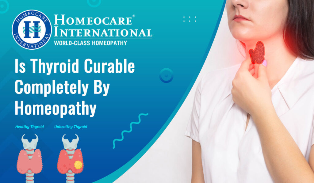 Thyroid Treatment in Homeopathy | Homeopathy Treatment for Thyroid Problems - Homeocare International