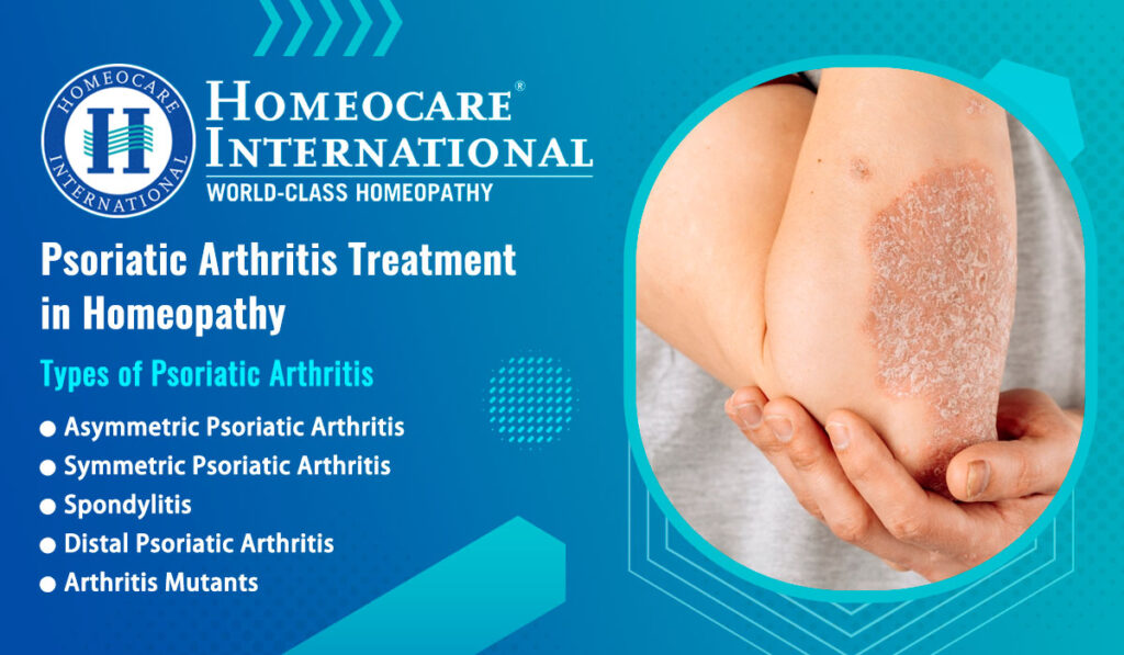 https://blog.homeocare.in/psoriatic-arthritis-treatment-in-homeopathy/