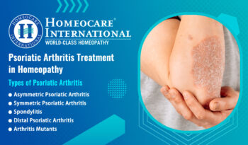 Psoriatic Arthritis treatment in Homeopathy