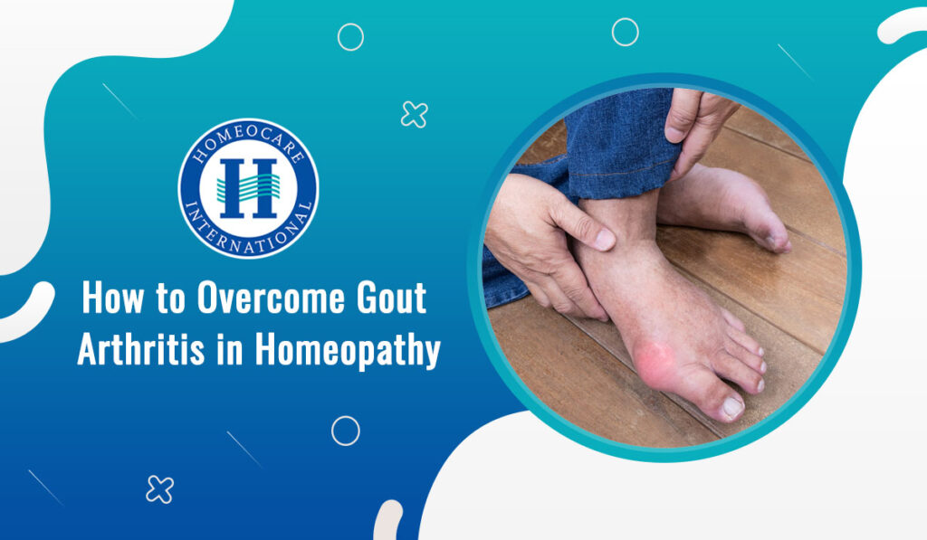 How to Overcome Gout Arthritis in Homeopathy