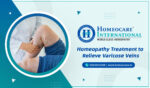 <strong>Homeopathy Treatment for Varicose Veins</strong>