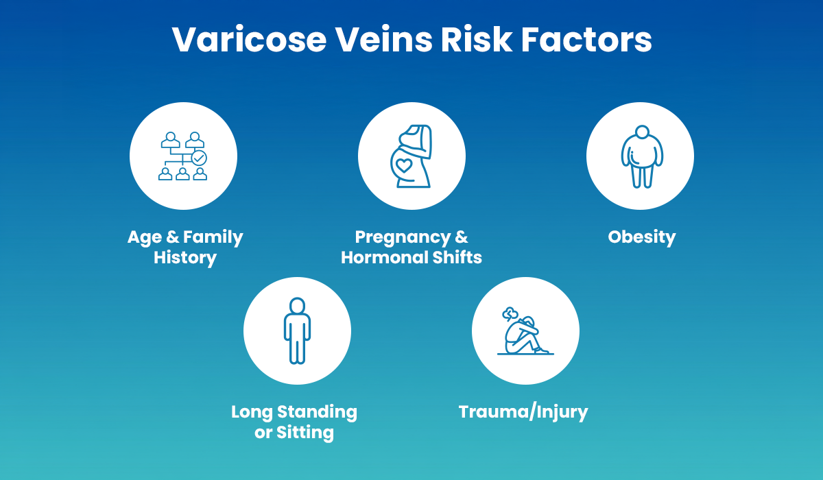 varicose veins risk factors