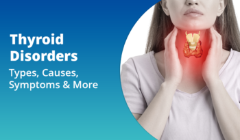 homeopathic remedies - thyroid disorders