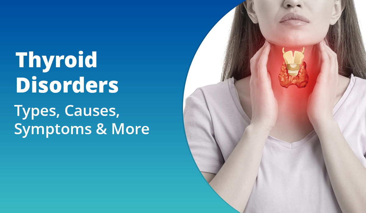 homeopathic remedies - thyroid disorders