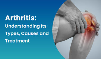 arthritis-understanding-its-types,-causes-and-treatment