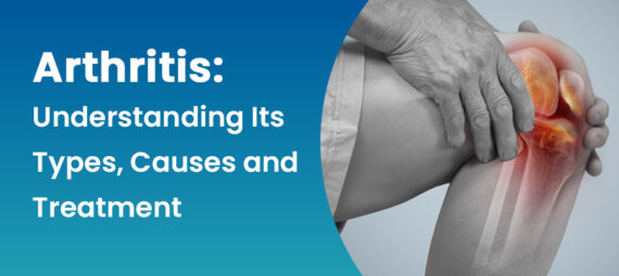 arthritis-understanding-its-types,-causes-and-treatment