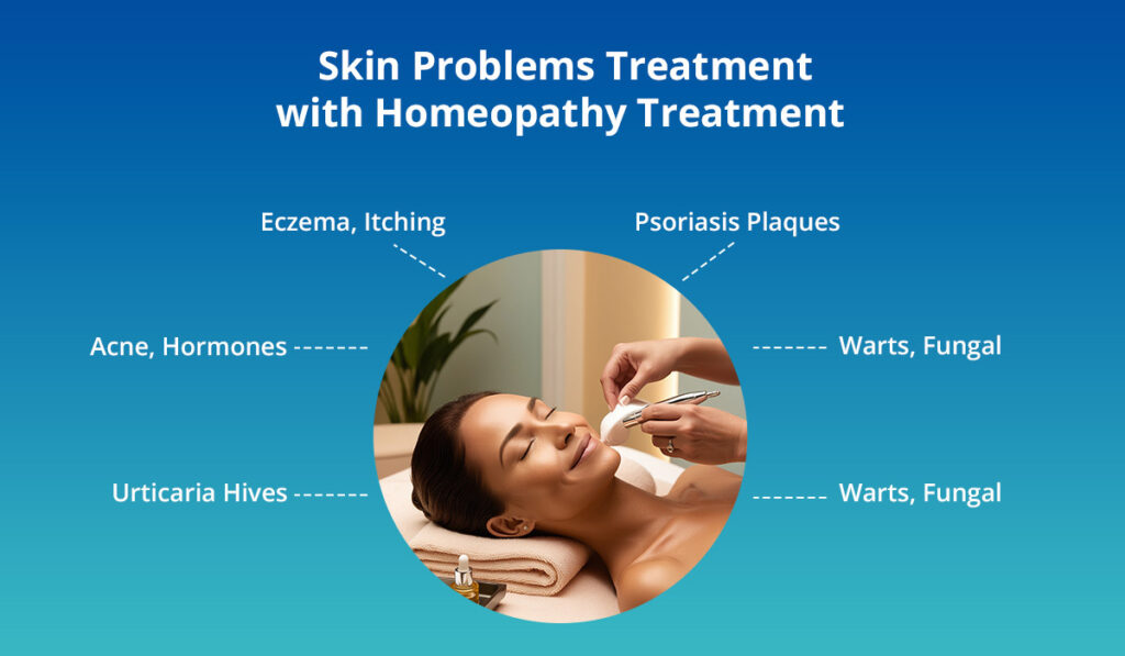 why choose homeopathy treatment for skin problems?