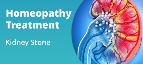 homeopathy treatment for kidney stone