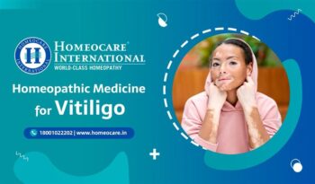 Homeocare International banner advertising homeopathic medicine for vitiligo; woman with vitiligo touching her cheeks inside a circular frame.