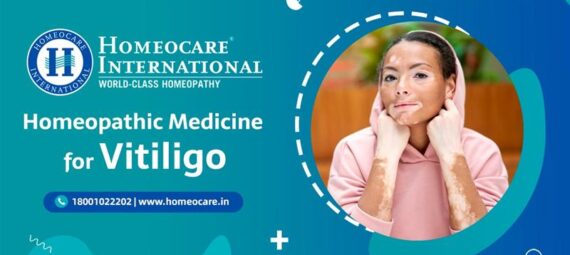 Homeocare International banner advertising homeopathic medicine for vitiligo; woman with vitiligo touching her cheeks inside a circular frame.