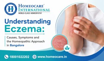Eczema awareness banner: arm with eczema patches on the right, Homeocare International logo and contact info.